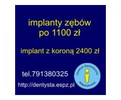 Implanty zębów  1100 zł